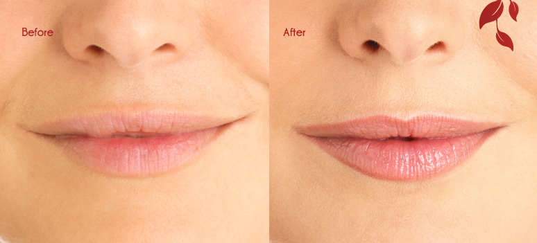 5 years after Lip Tattoo by... - Permanent Makeup Philippines | Facebook